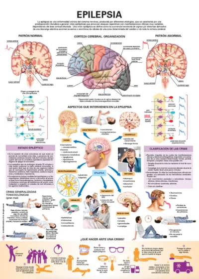 Epilepsia