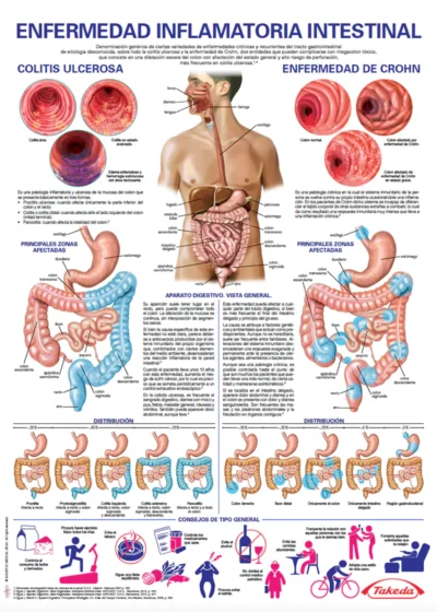 Enfermedades Inflamatoria Intestinal