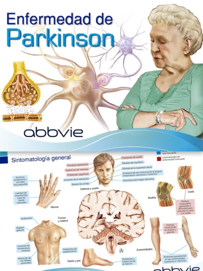 Enfermedad de Parkinson