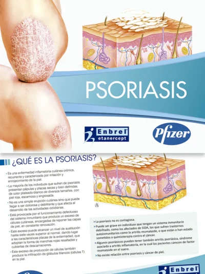 Psoriasis