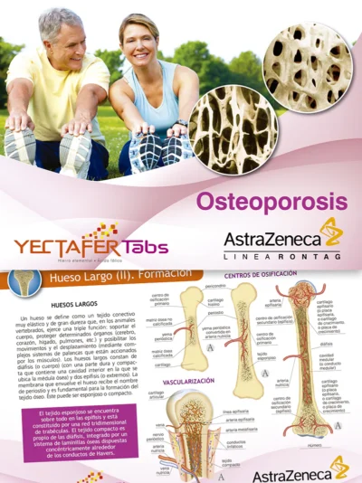 Osteoporosis