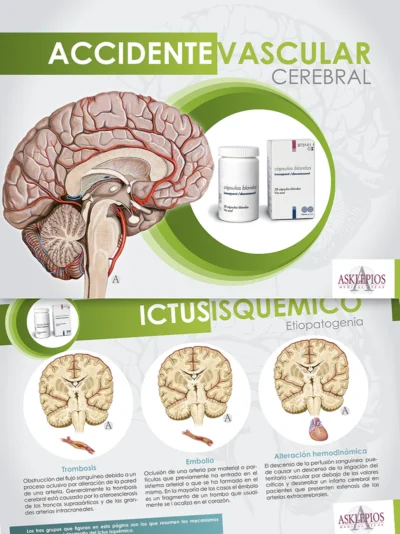 Accidentevascular Cerebral