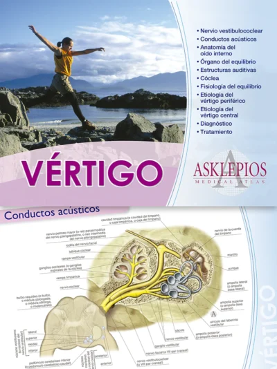 Vertigo