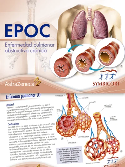 EPOC