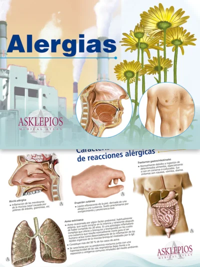 Alergias