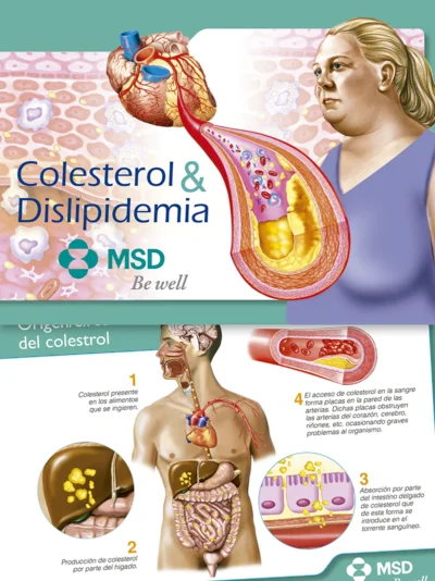 Colesterol & Dislipidemia