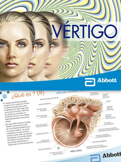 Vertigo