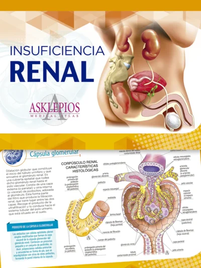 Insuficiencia Renal