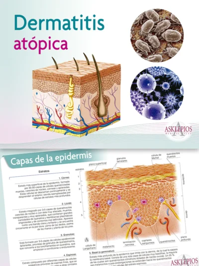 Dermatitia Atópica