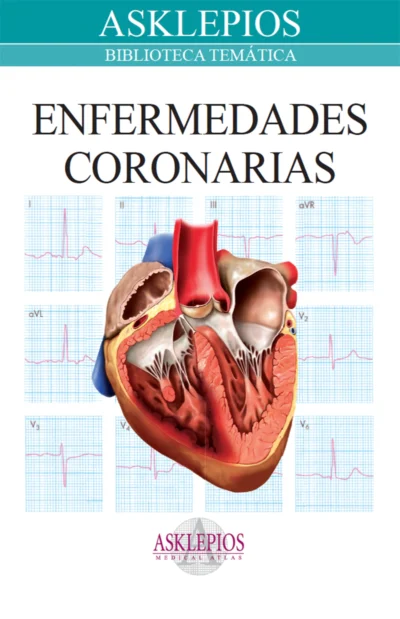 Enfermedades Cononarias