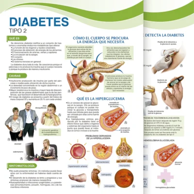 Diabetes. Tipo 2