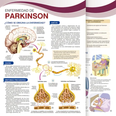 Enfermedad de Parkinson