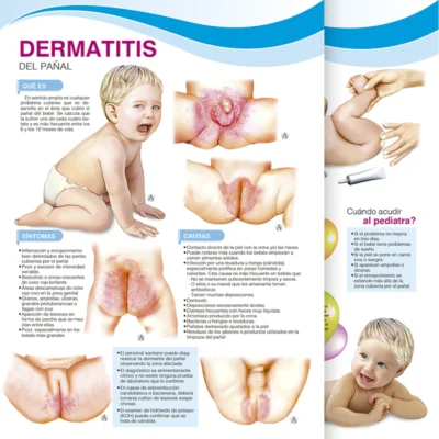 Dermatitis del Pañal