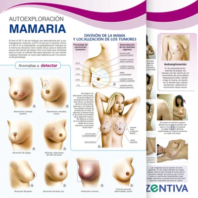 Autoexploración Mamaria
