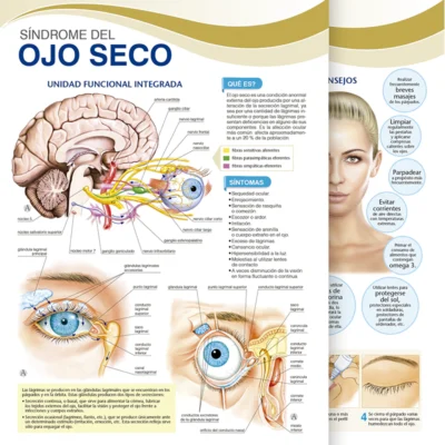 Síndrome del ojo seco