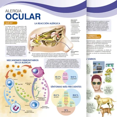 Alergio Ocular