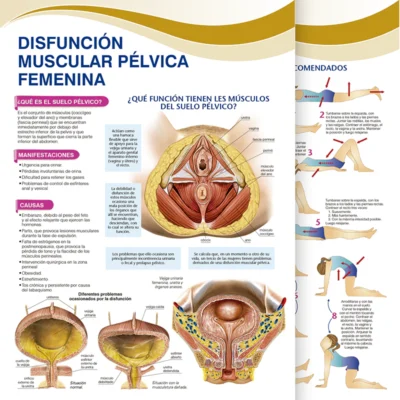 Difunción muscular pélvica Femenina