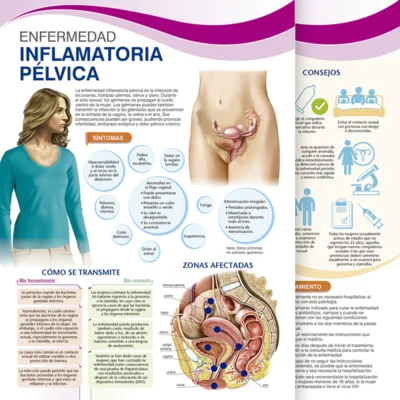 Enfermedad Inflamatoria pélvica