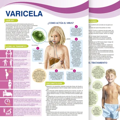 Varicela