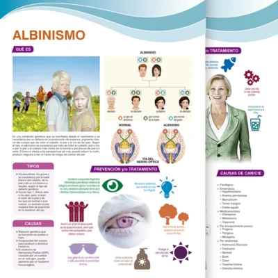 Albinismo