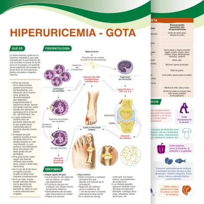 Hiperuricemia - Gota
