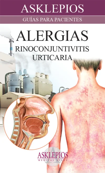 Alergias