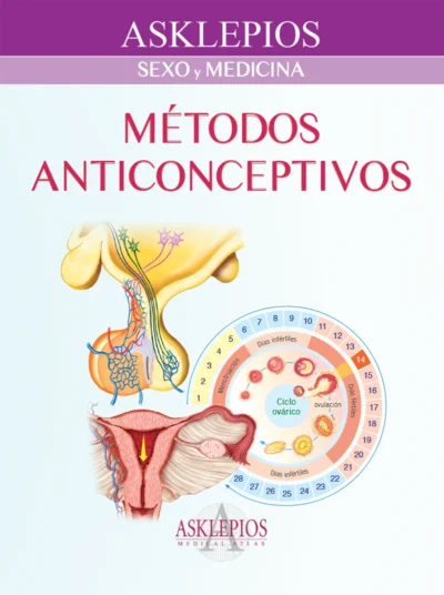 Métodos Anticónceptivos